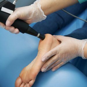 Plantar fasciitis therapie clearance